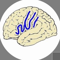 cavernome cérébral symptomes