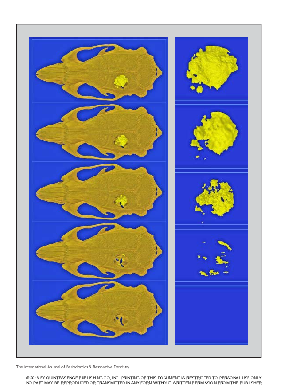 (PDF) Real-Time Assessment of Guided Bone Regeneration in Standardized ...