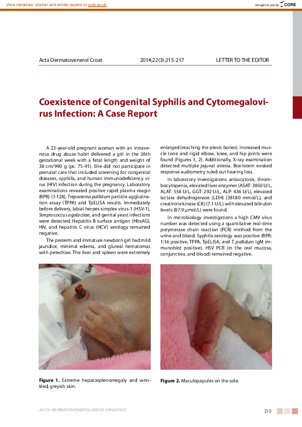 (PDF) Coexistence of congenital syphilis and cytomegalovirus infection ...