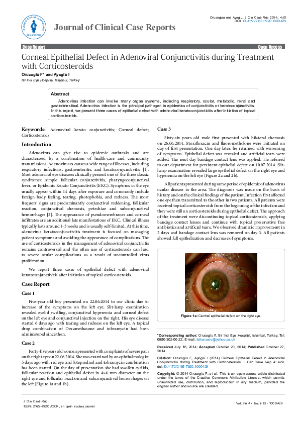 (PDF) Corneal Epithelial Defect in Adenoviral Conjunctivitis during ...