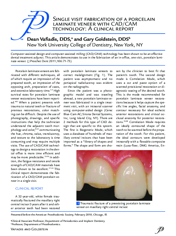 (PDF) One-Visit Porcelain Laminate Veneer using CAD/CAM Technology
