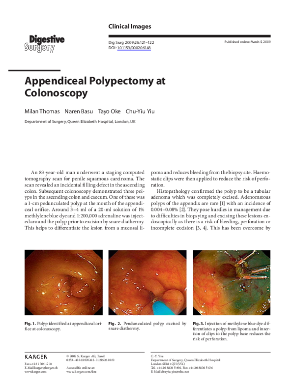 (PDF) Appendiceal Polypectomy at Colonoscopy