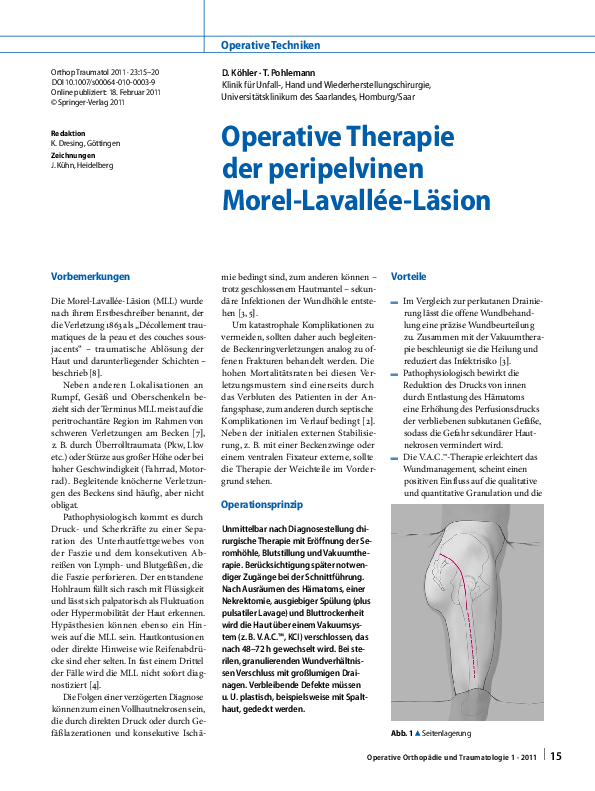 (PDF) Operative Therapie der peripelvinen MorelLavalléeLäsion Tim