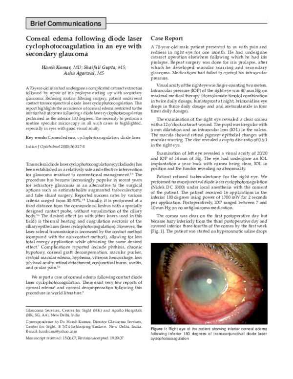 (PDF) Corneal edema following diode laser cyclophotocoagulation in an