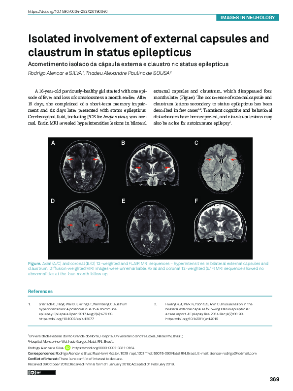 (PDF) Isolated involvement of external capsules and claustrum in status ...