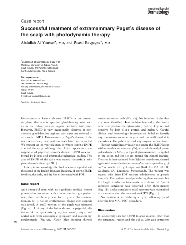 (PDF) Successful treatment of extramammary Paget's disease of the scrotum with imiquimod 5