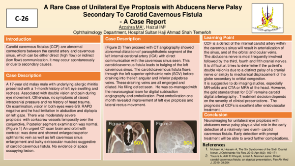 (PDF) A Rare Case of Unilateral Eye Proptosis with Abducens Nerve Palsy ...
