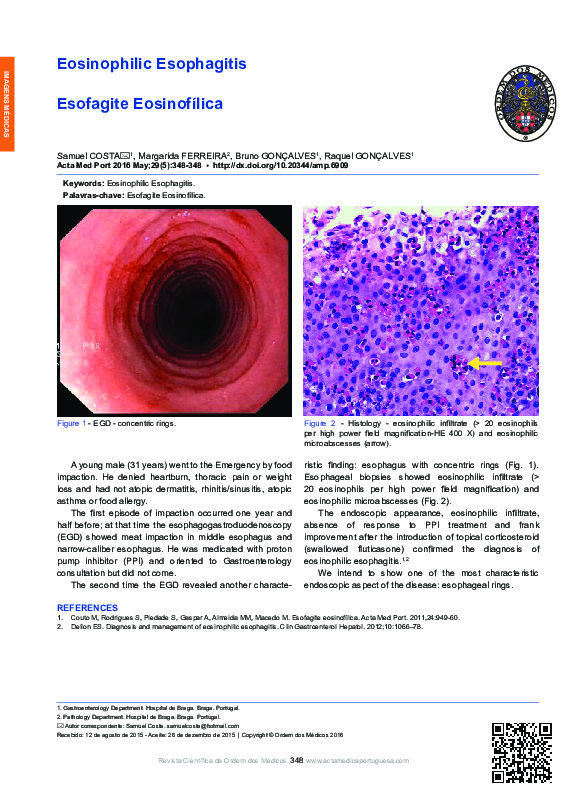 (PDF) Eosinophilic Esophagitis