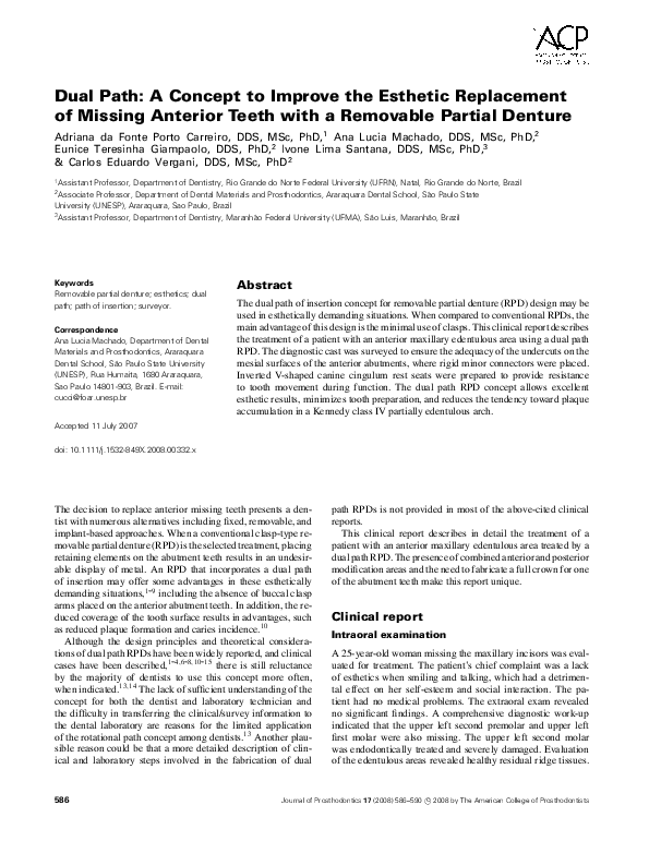 (PDF) Dual Path: A Concept to Improve the Esthetic Replacement of ...