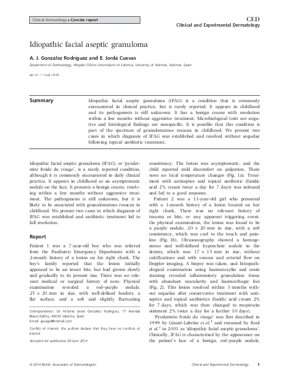 (PDF) Idiopathic Facial Aseptic Granuloma guilherme castela