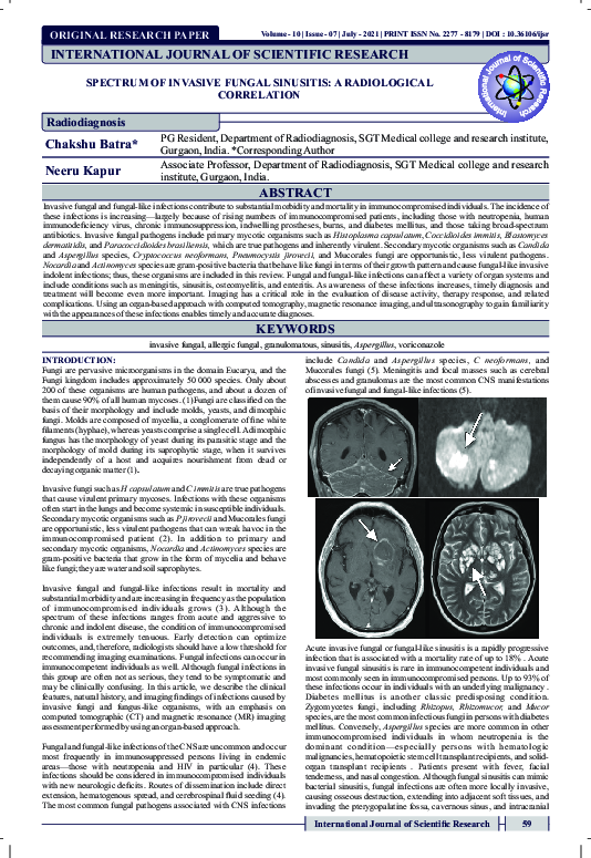 (PDF) Spectrum of Invasive Fungal Sinusitis: A Radiological Correlation