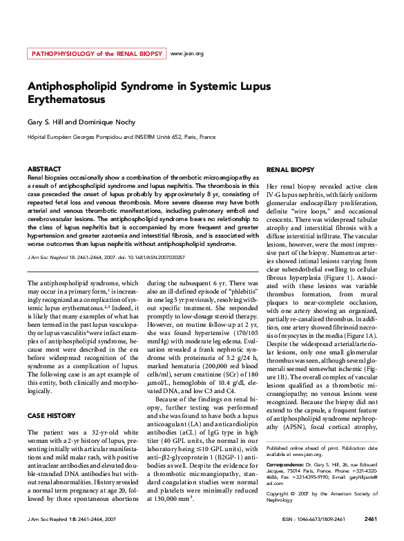 (PDF) Antiphospholipid Syndrome in Systemic Lupus Erythematosus