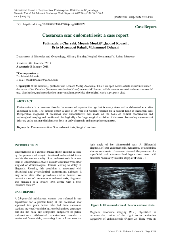 (PDF) Caesarean scar endometriosis: a case report