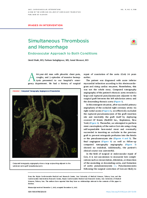(PDF) Simultaneous Thrombosis and Hemorrhage Parham Sadeghipour