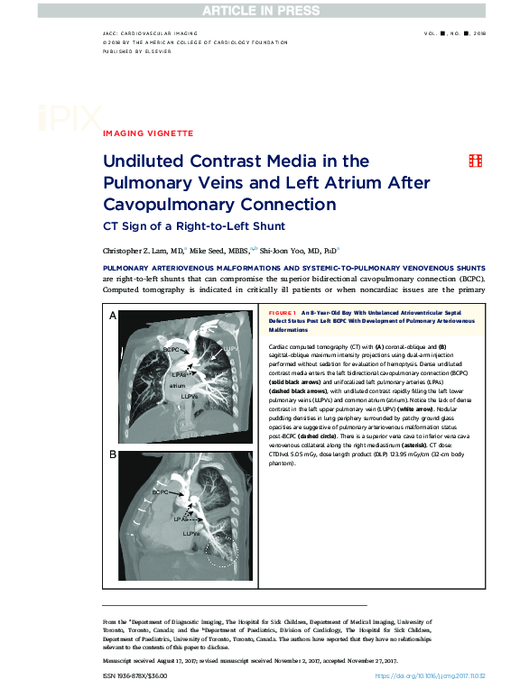 (PDF) Undiluted Contrast Media in the Pulmonary Veins and Left Atrium ...