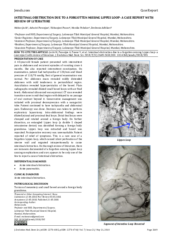 (PDF) Intestinal Obstruction Due to a Forgotten Missing Lippes Loop- a ...
