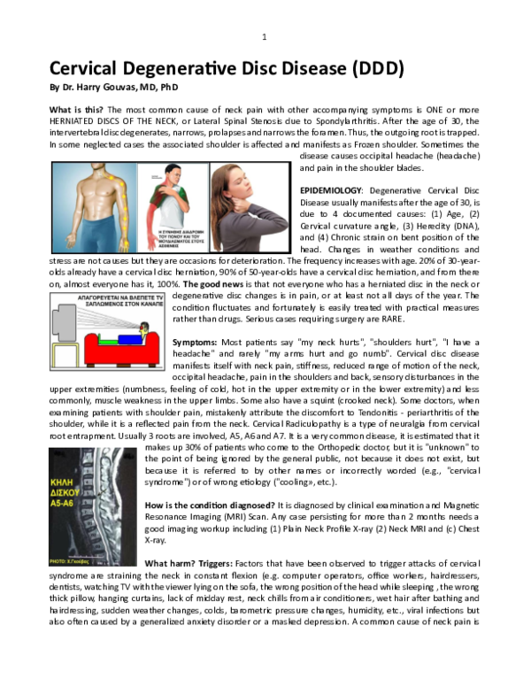 (PDF) Cervical Degenerative Disc Disease (DDD)