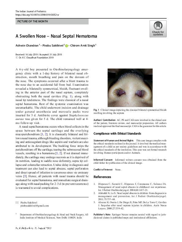 (PDF) A Swollen Nose – Nasal Septal Hematoma | Ashwin chandran ...