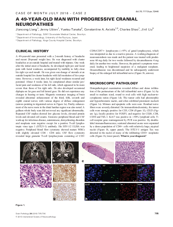 (PDF) Brain pathology case of the month - July 2016 - case 2 A 49-Year ...