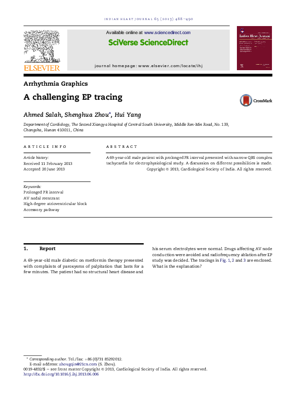 (PDF) A challenging EP tracing