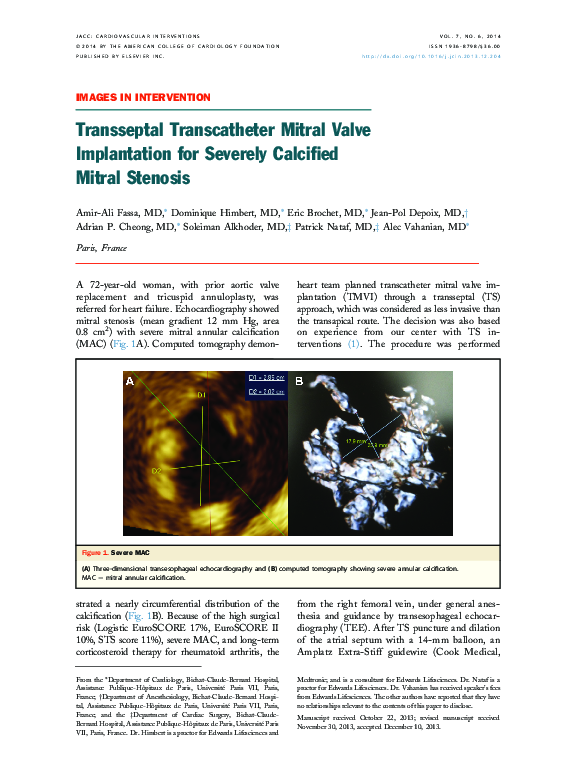 (PDF) Transseptal Transcatheter Mitral Valve Implantation for Severely ...