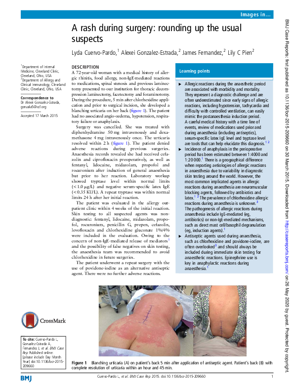 (PDF) A rash during surgery: rounding up the usual suspects