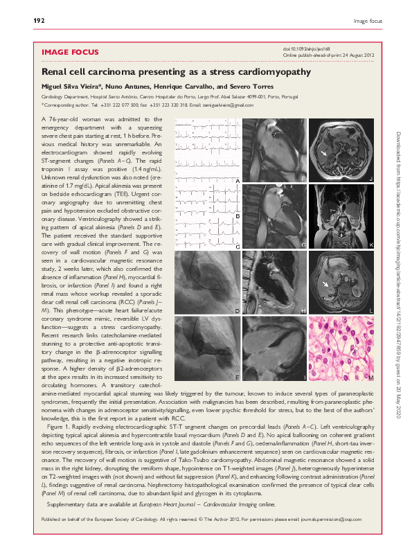 (PDF) Renal cell carcinoma presenting as a stress cardiomyopathy