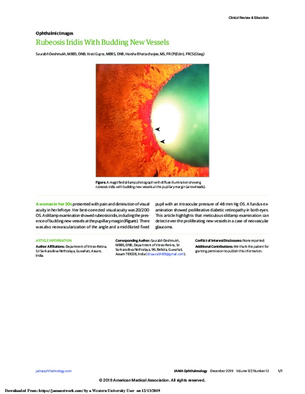 (PDF) Rubeosis Iridis With Budding New Vessels