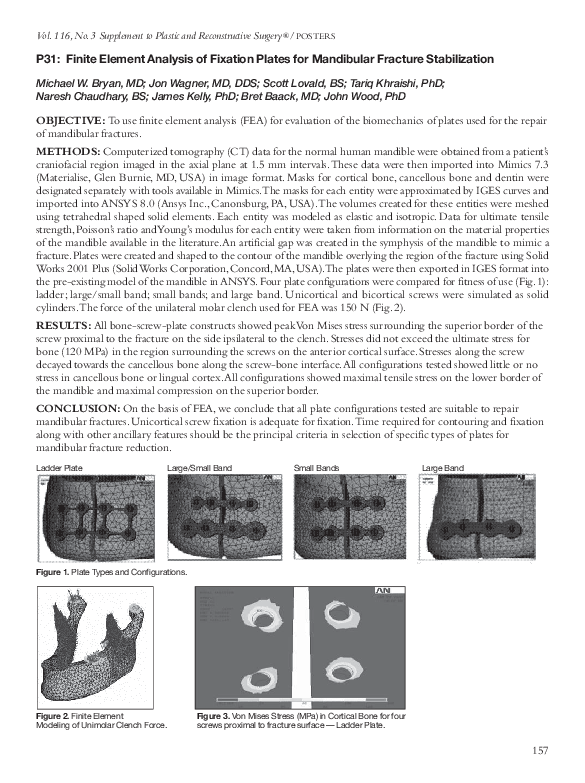 (PDF) Finite Element Analysis of Fixation Plates for Mandibular ...