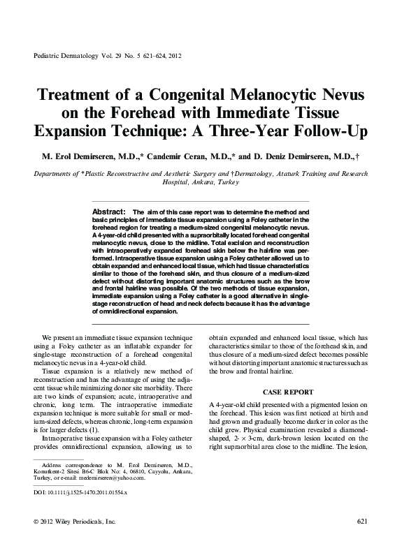 (PDF) Treatment of a Congenital Melanocytic Nevus on the Forehead with ...