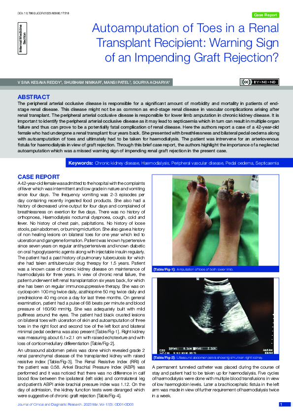 (PDF) Autoamputation of Toes in a Renal Transplant Recipient: Warning ...