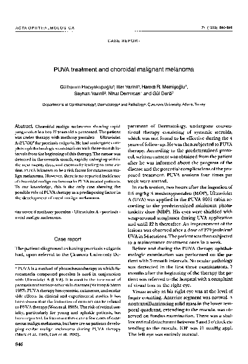 (PDF) PUVA treatment and choroidal malignant melanoma | Hamdi R ...