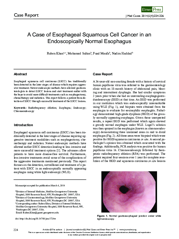 (PDF) A Case of Esophageal Squamous Cell Cancer in an Endoscopically ...