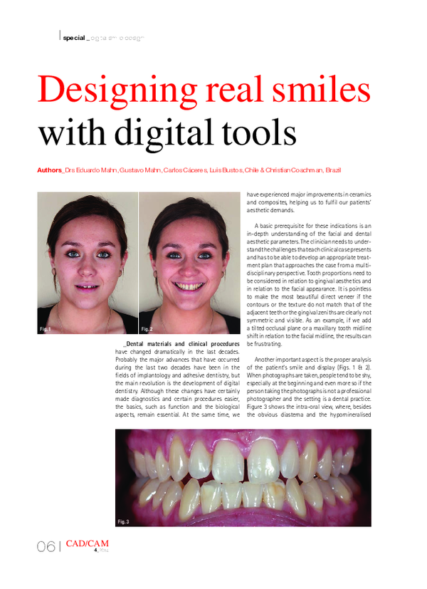(PDF) Designing real smiles with digital tools