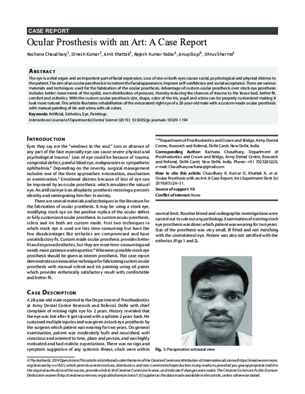 (PDF) Ocular Prosthesis with an Art: A Case Report