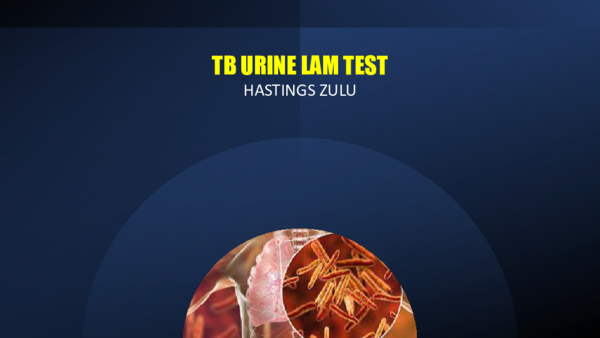(PPT) TB URINE LAM TEST