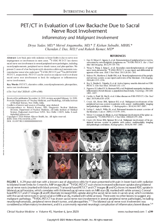 (PDF) PET/CT in Evaluation of Low Backache Due to Sacral Nerve Root ...
