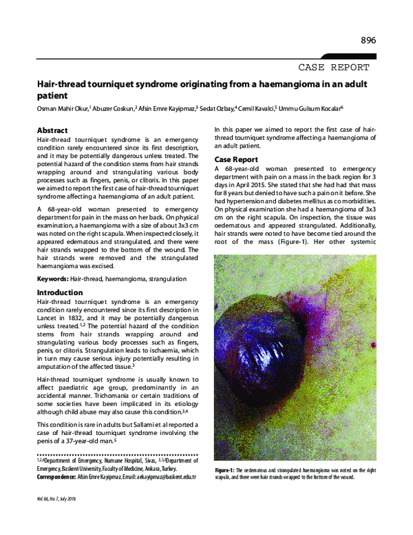 (PDF) Hairthread tourniquet syndrome originating from a haemangioma in