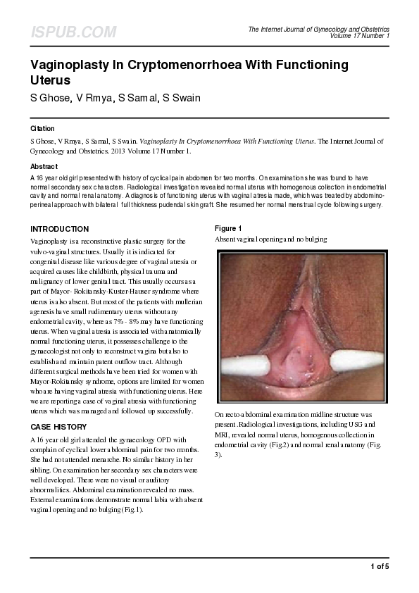 PDF Vaginoplasty In Cryptomenorrhoea With Functioning Uterus 