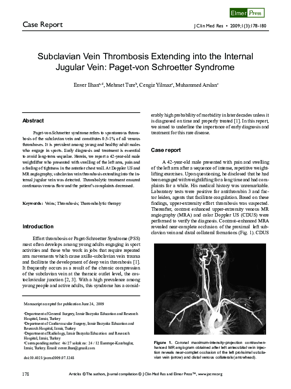 (PDF) Subclavian Vein Thrombosis Extending into the Internal Jugular ...