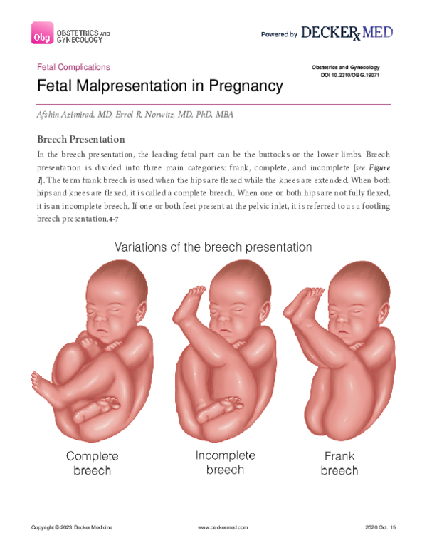 (PDF) Fetal Malpresentation in Pregnancy