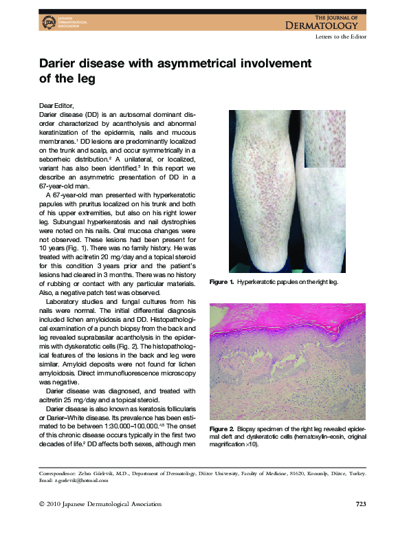 (PDF) Darier disease with asymmetrical involvement of the leg