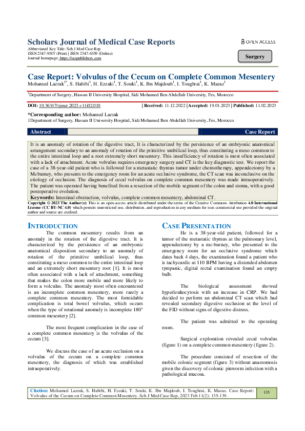 (PDF) Case Report Volvulus of the Cecum on Complete Common Mesentery