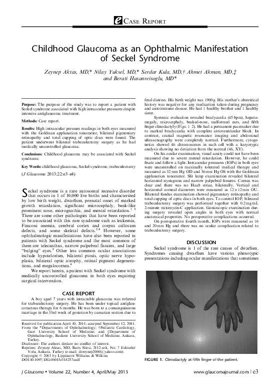 (PDF) Childhood Glaucoma as an Ophthalmic Manifestation of Seckel Syndrome