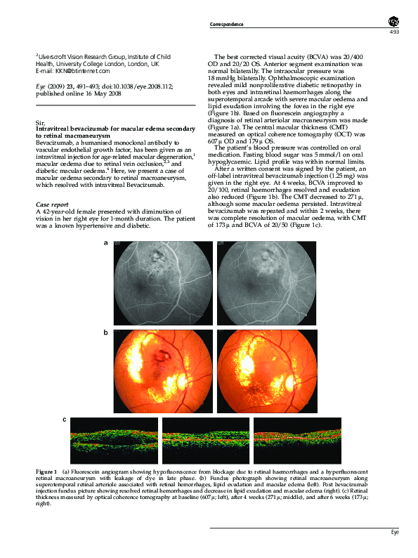 (PDF) Intravitreal bevacizumab for macular edema secondary to retinal ...