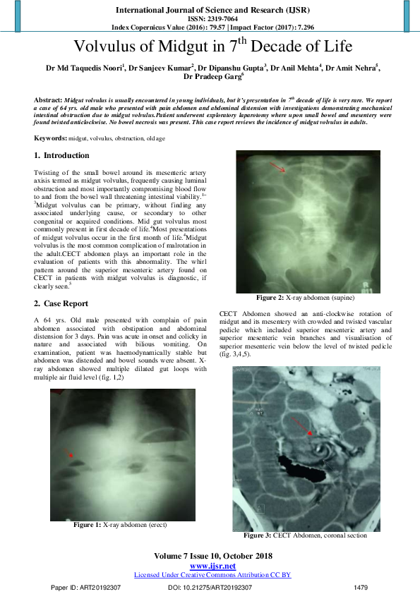 (PDF) Volvulus of Midgut in 7 th Decade of Life Dr