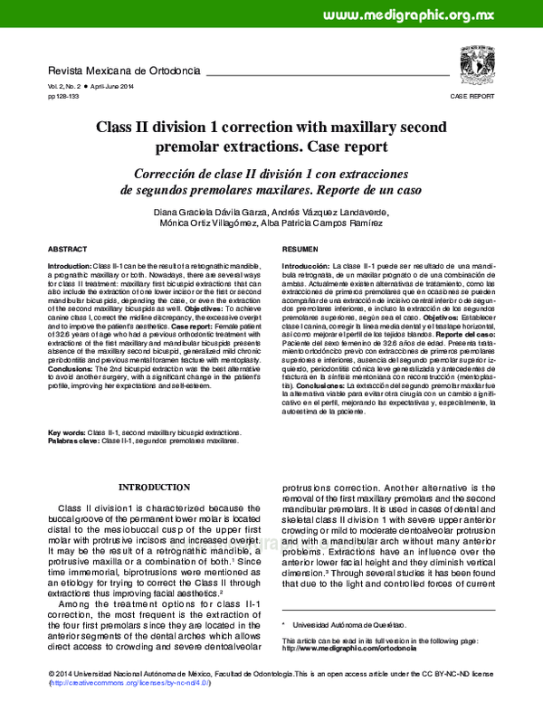 (PDF) Class II division 1 correction with maxillary second premolar ...