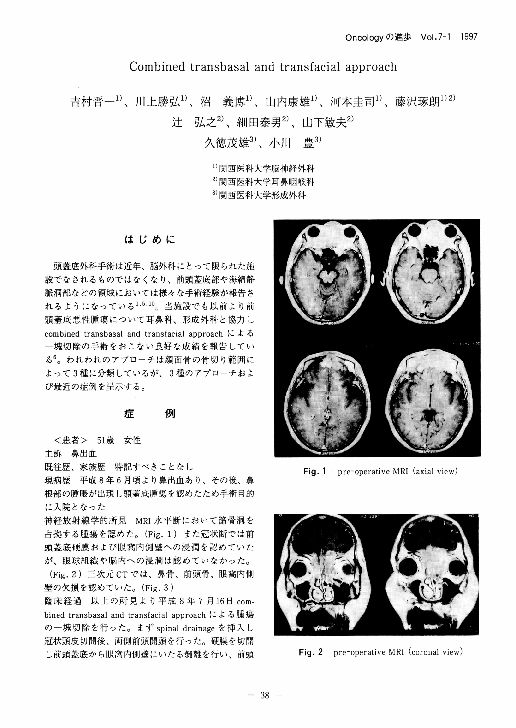 (PDF) Combined transbasal and transfacial approach