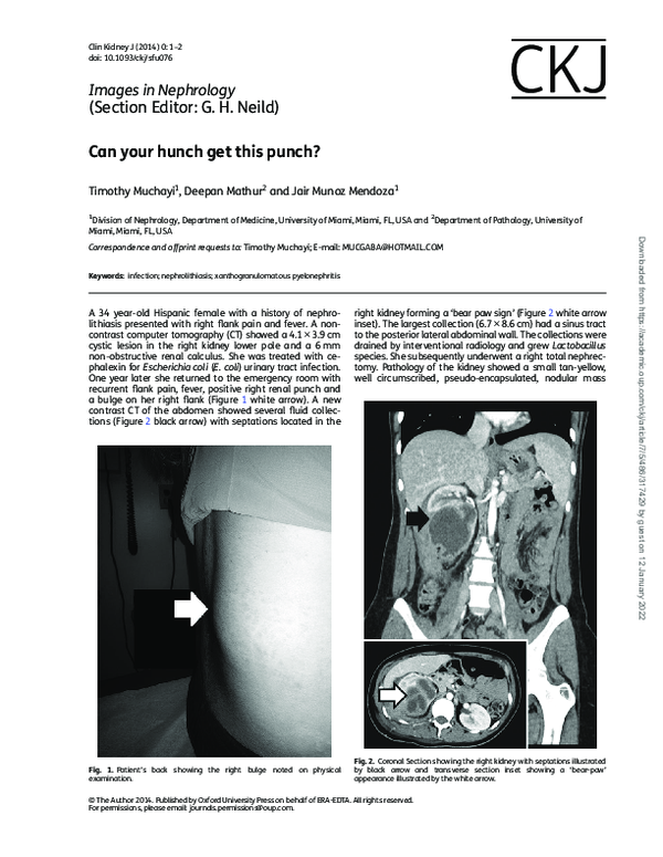 (PDF) Images in Nephrology (Section Editor: G. H. Neild) Can your hunch ...