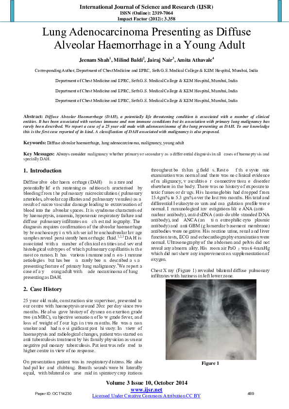 (PDF) Lung Adenocarcinoma Presenting as Diffuse Alveolar Haemorrhage in ...